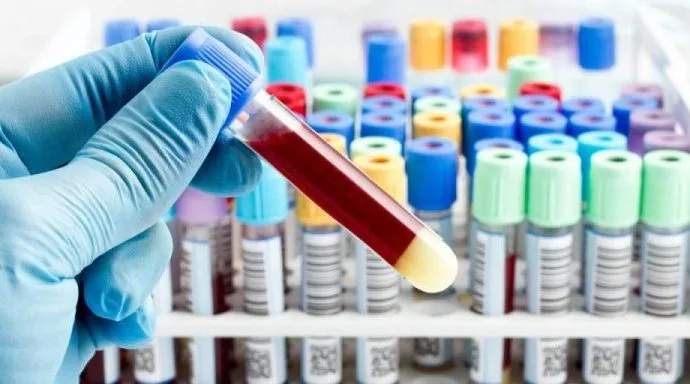 COLETAS DE EXAMES LABORATORIAIS EM ANDRADINA