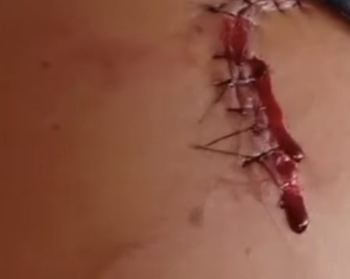 TENTATIVA DE HOMICÍDIO EM NOVA INDEPENDÊNCIA: 2 VÍTIMAS NA PRAÇA