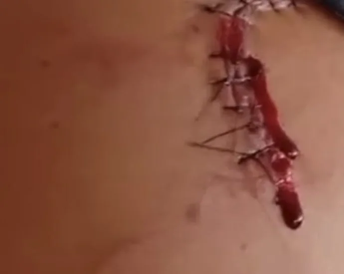 TENTATIVA DE HOMICÍDIO EM NOVA INDEPENDÊNCIA: 2 VÍTIMAS NA PRAÇA