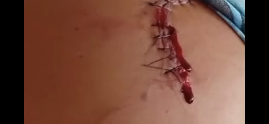 TENTATIVA DE HOMICÍDIO EM NOVA INDEPENDÊNCIA: 2 VÍTIMAS NA PRAÇA