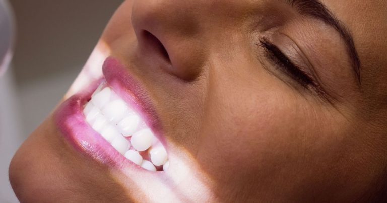 PROIBIÇÃO DE FITAS CLAREADORAS DENTAIS: ANVISA AGE