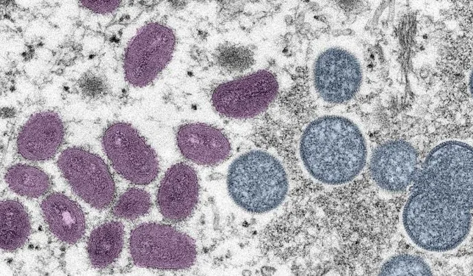 MPOX: PREVENÇÃO É A CHAVE EM PORTO ALEGRE
