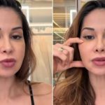 Maíra Cardi Anuncia Cirurgia Após Complicações de Procedimento Estético