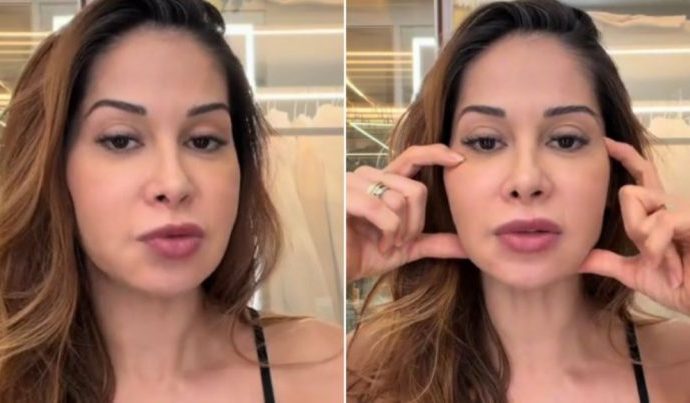 Maíra Cardi Anuncia Cirurgia Após Complicações de Procedimento Estético Maíra Cardi Anuncia Cirurgia Após Complicações de Procedimento Estético