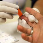 SUS Introduz Doxiciclina como Medida Preventiva Contra ISTs