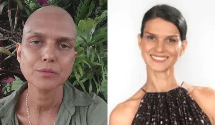 Ex-participante do ‘The Voice Brasil’ lança vaquinha para tratamento de câncer
