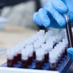 Importância do Diagnóstico Precoce do Câncer de Próstata é Destacada em Conversa com Dr. Kalil