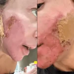 Maya Massafera Compartilha Experiência com Procedimento Estético Agressivo