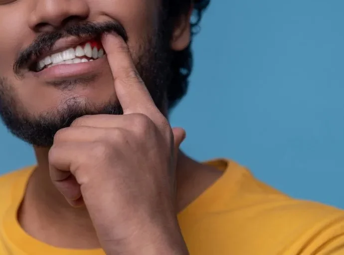 TEM DIABETES E IMPLANTE DENTÁRIO? VEJA SINAIS NA GENGIVA QUE EXIGEM ATENÇÃO