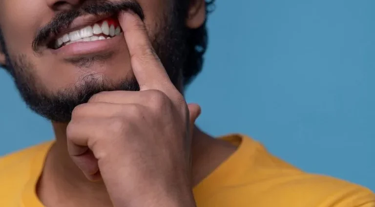 TEM DIABETES E IMPLANTE DENTÁRIO? VEJA SINAIS NA GENGIVA QUE EXIGEM ATENÇÃO TEM DIABETES E IMPLANTE DENTÁRIO? VEJA SINAIS NA GENGIVA QUE EXIGEM ATENÇÃO
