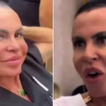 Gretchen compartilha desafios no tratamento contra alopecia após micropigmentação