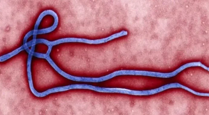 Caso suspeito de Ebola é descartado no Rio Grande do Sul