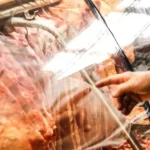 China impõe taxa de 67% sobre carne de MS: impactos para produtores e consumidores