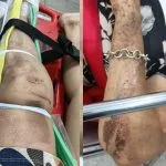 Prisão preventiva de suspeito de agressão a médica e atropelamento de idosa em Santa Fé do Sul