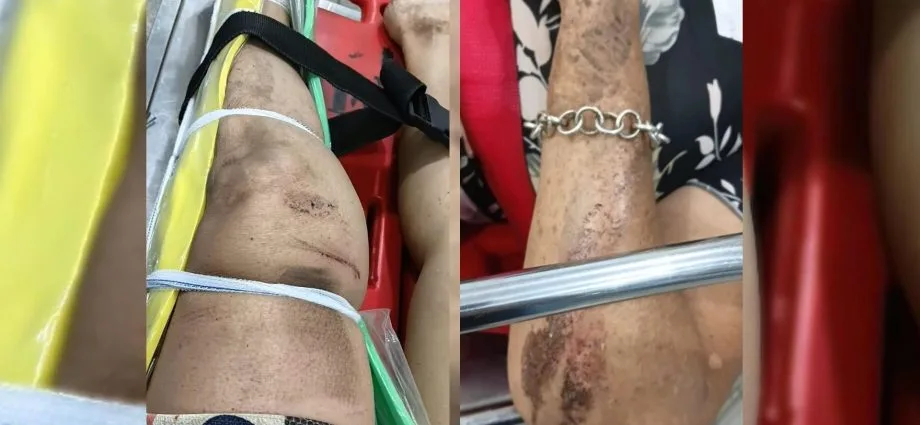 Prisão preventiva de suspeito de agressão a médica e atropelamento de idosa em Santa Fé do Sul
