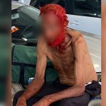 Empresário é processado por discriminação após tingir cabelo e barba de idoso em situação de rua