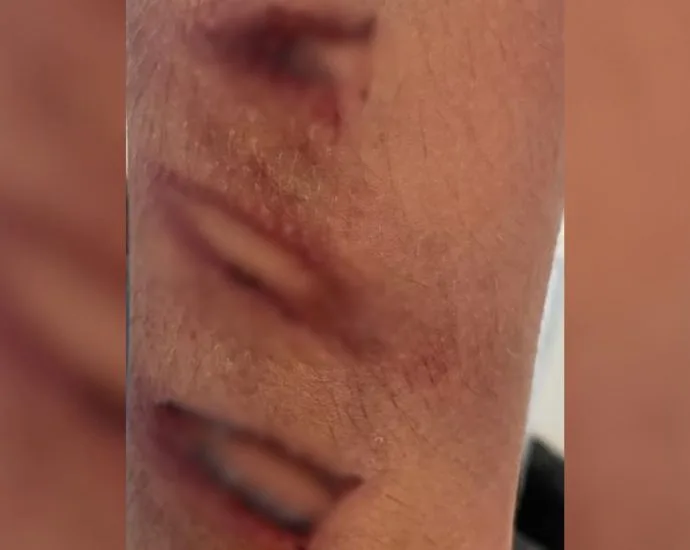 Homem é preso por maus-tratos a enteado em Araçatuba Homem é preso por maus-tratos a enteado em Araçatuba